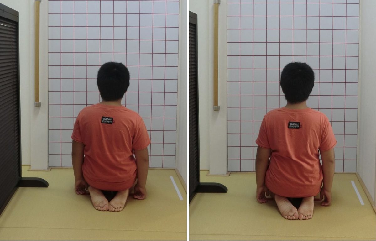 座った姿勢の傾き（背面）の施術前（左）と施術後（右）の比較写真