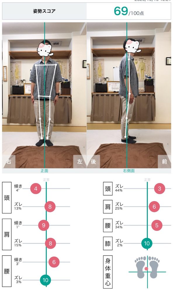 姿勢分析アプリの結果画面　姿勢スコア69点（顔は隠しています）