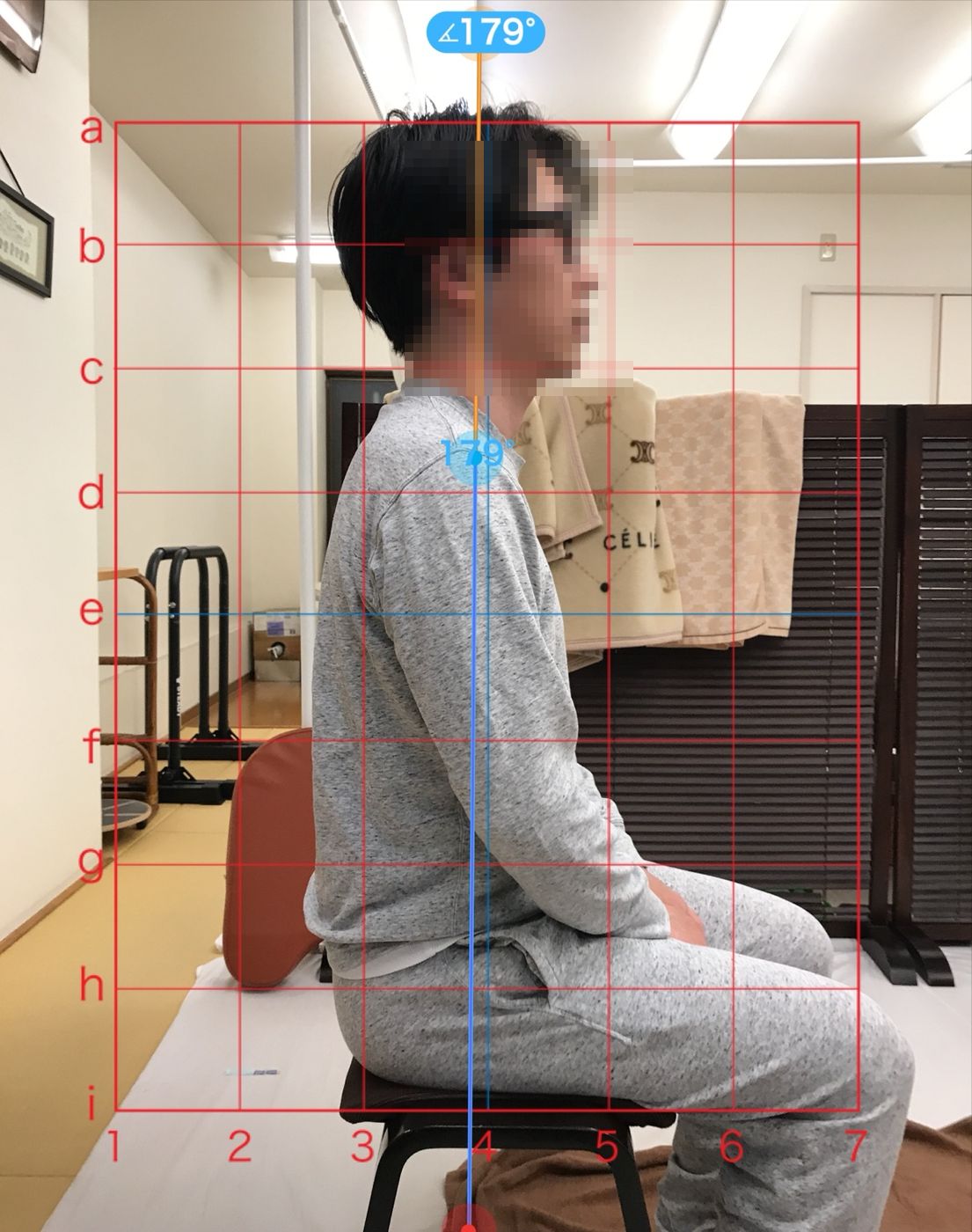 施術後の座った姿勢を側面から撮影した写真　表示された角度は179度