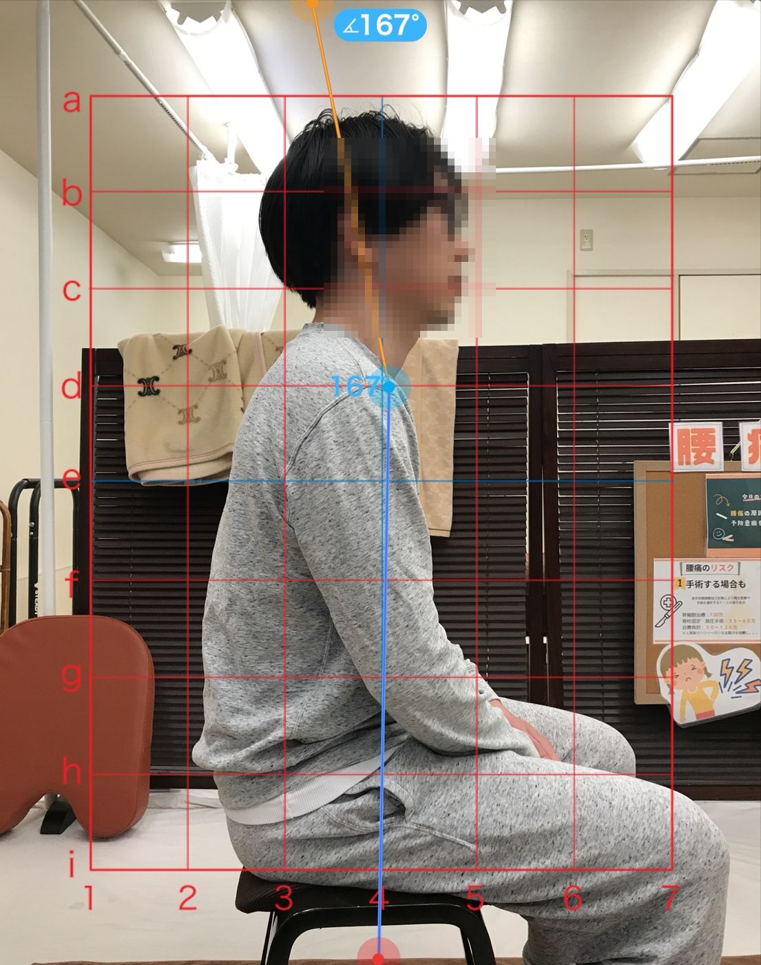施術前の座った姿勢を側面から撮影した写真　表示された角度は167度